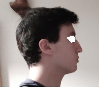 Before