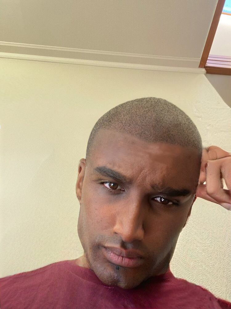 Rhyno  Smp  skincare