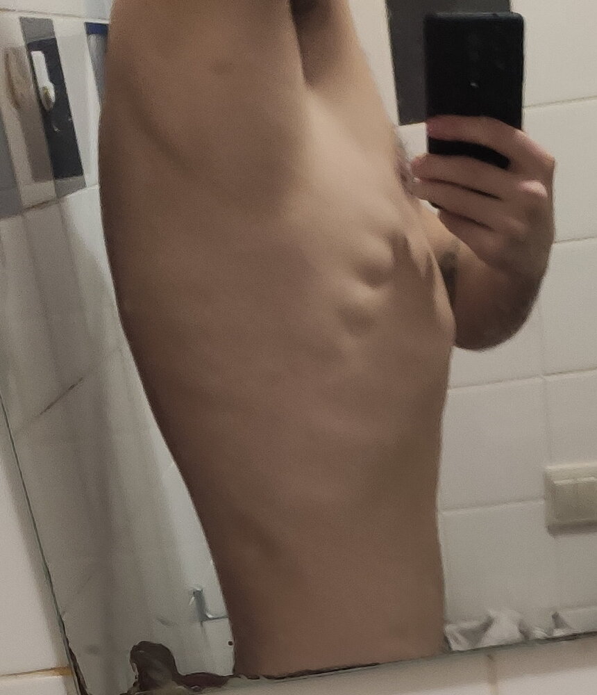 Puffedupribcage2
