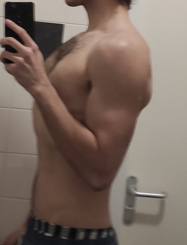 Side1