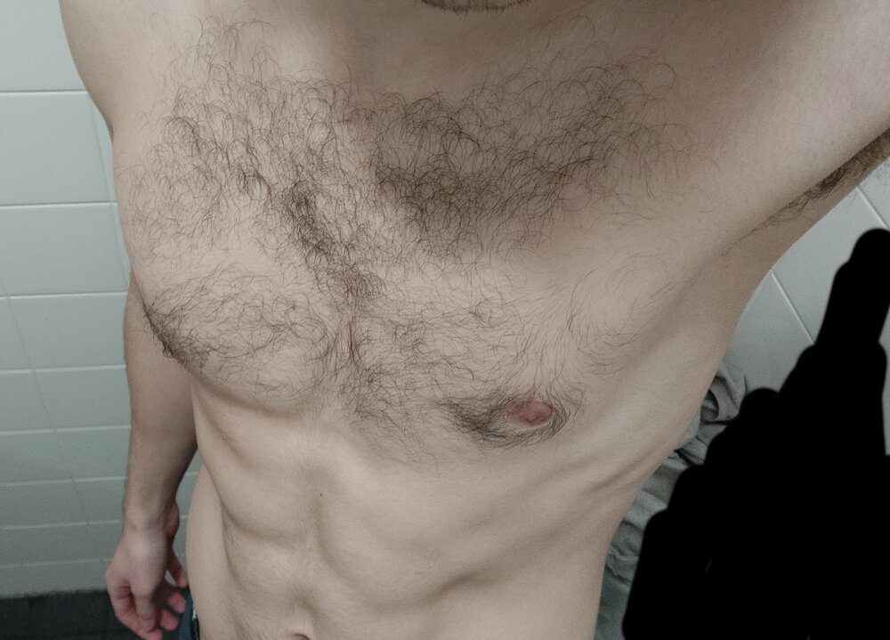 Abs3