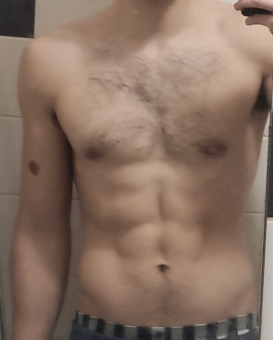 Abs1