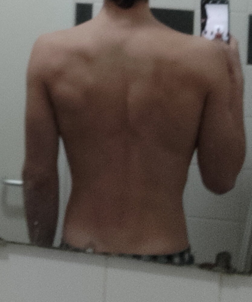 Back1