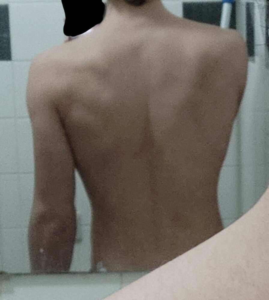 Back2