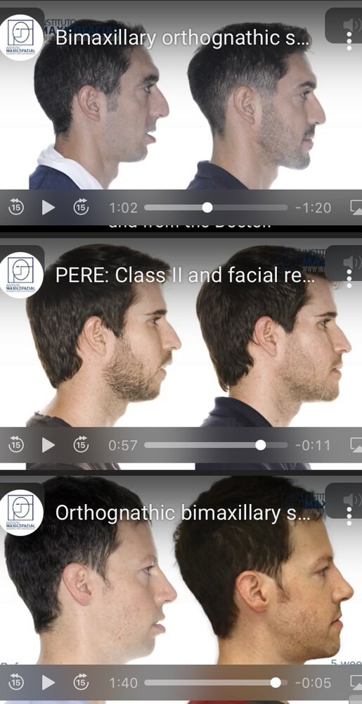 5F5FF301 D02A 4634 A6B9 072E5C11CACB