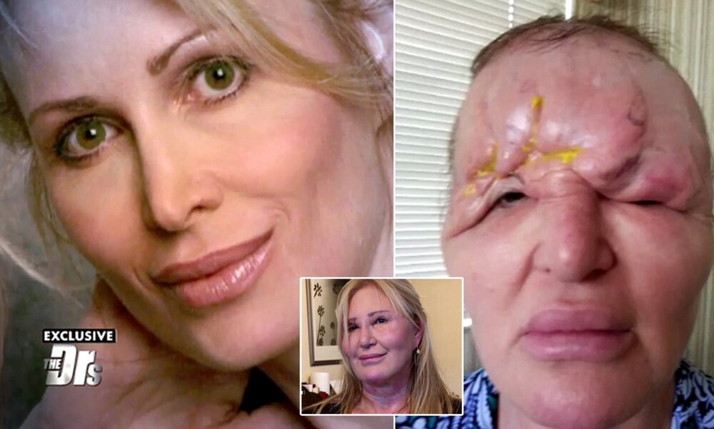 3C4533D600000578 0 image a 17 1484818291969