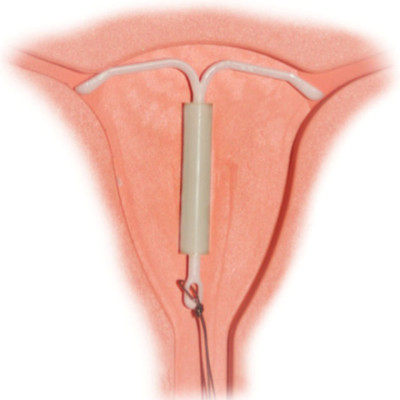 E0F693E8 F62D 4915 96A9 51A25FC9595B