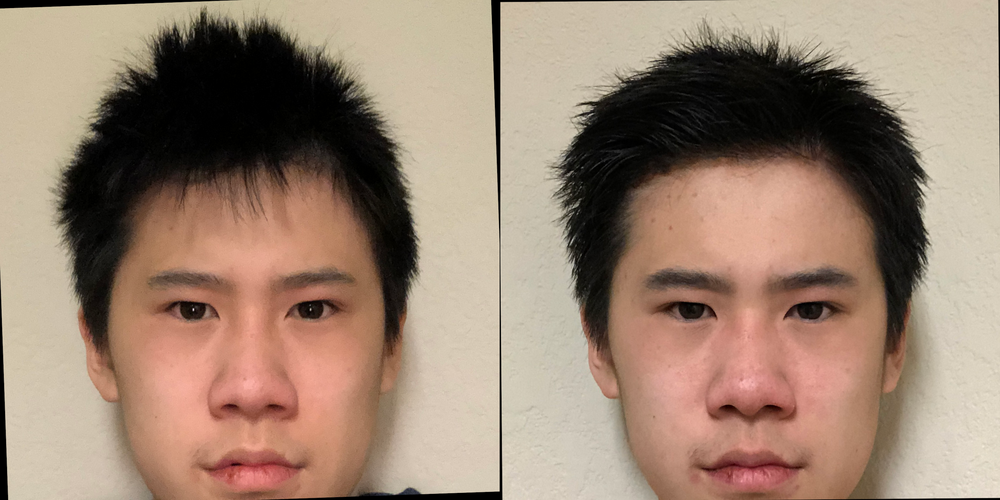 Hairmax