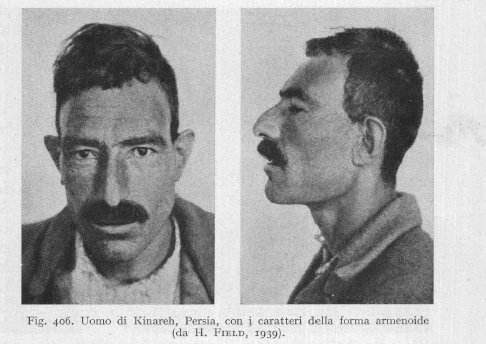 2 armenoid race