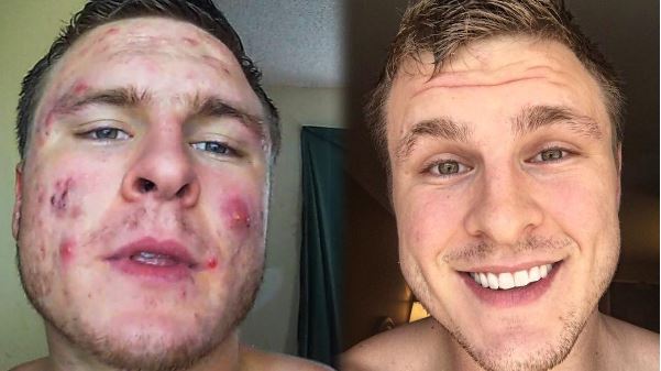 F1773CFE B901 44C2 BDCE 83B84EE9F5E5