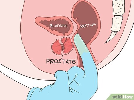 V4 460px Locate Your Prostate Step 9 Version 2