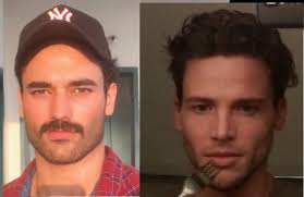 Amnesia or Salludon? | Looksmax.me - Men's Self-Improvement & Aesthetics