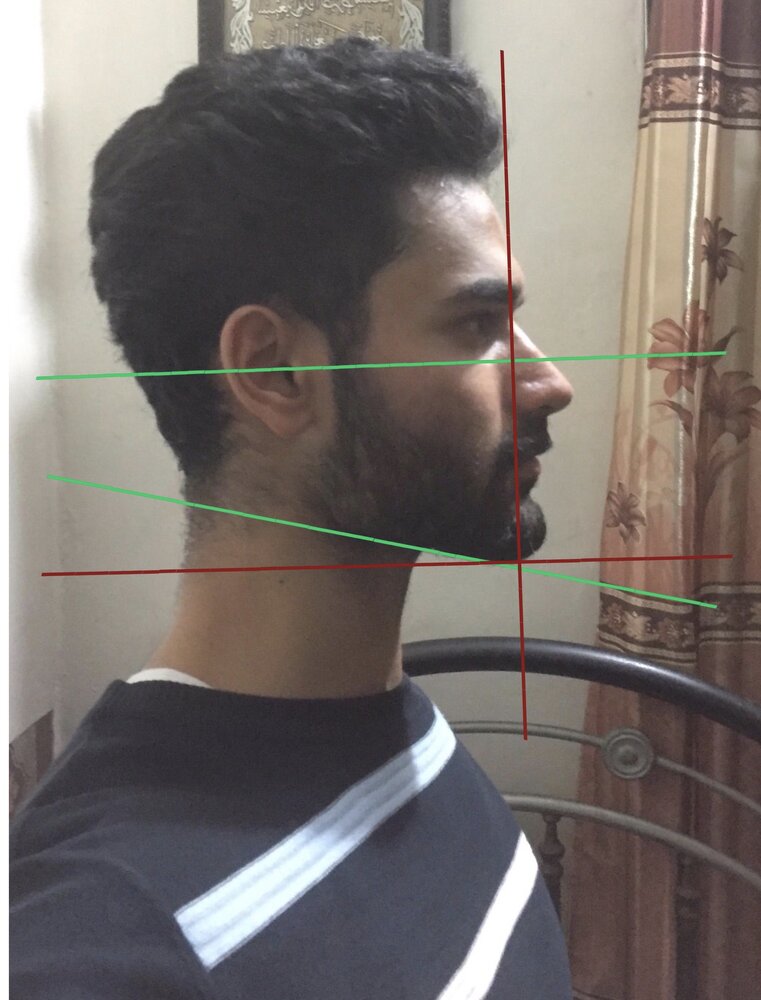 2856FD3D 605A 4621 AAD5 5EA9C729DA9C