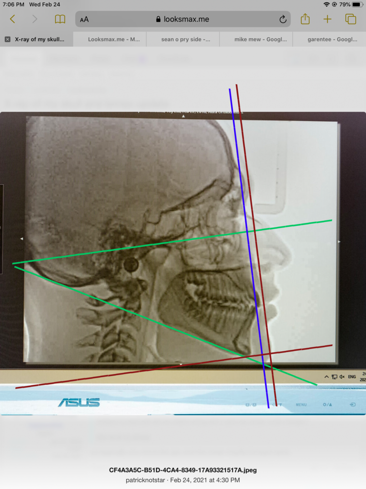 D5950F0A 7231 401E BF40 08E3A275EA2A