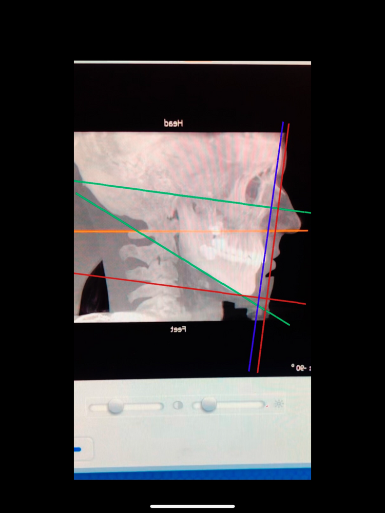 0A0058AB 8528 471B 8EE6 F3B012E6A0BF