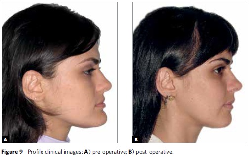 A28fig9