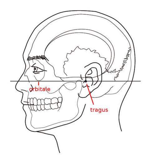 Head alignment according to the Frankfurt plane