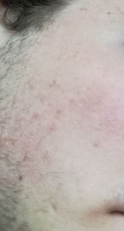 skin2.JPG