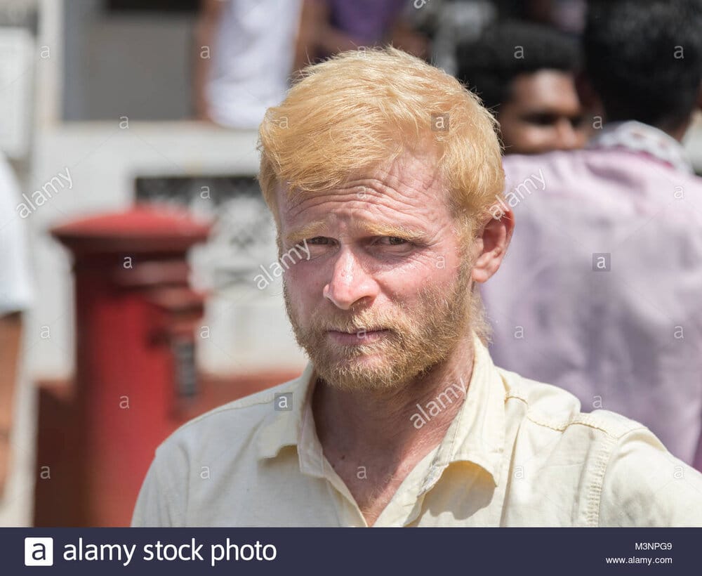 Albino man indian hindu blonde white parade matale sri lanka M3NPG9