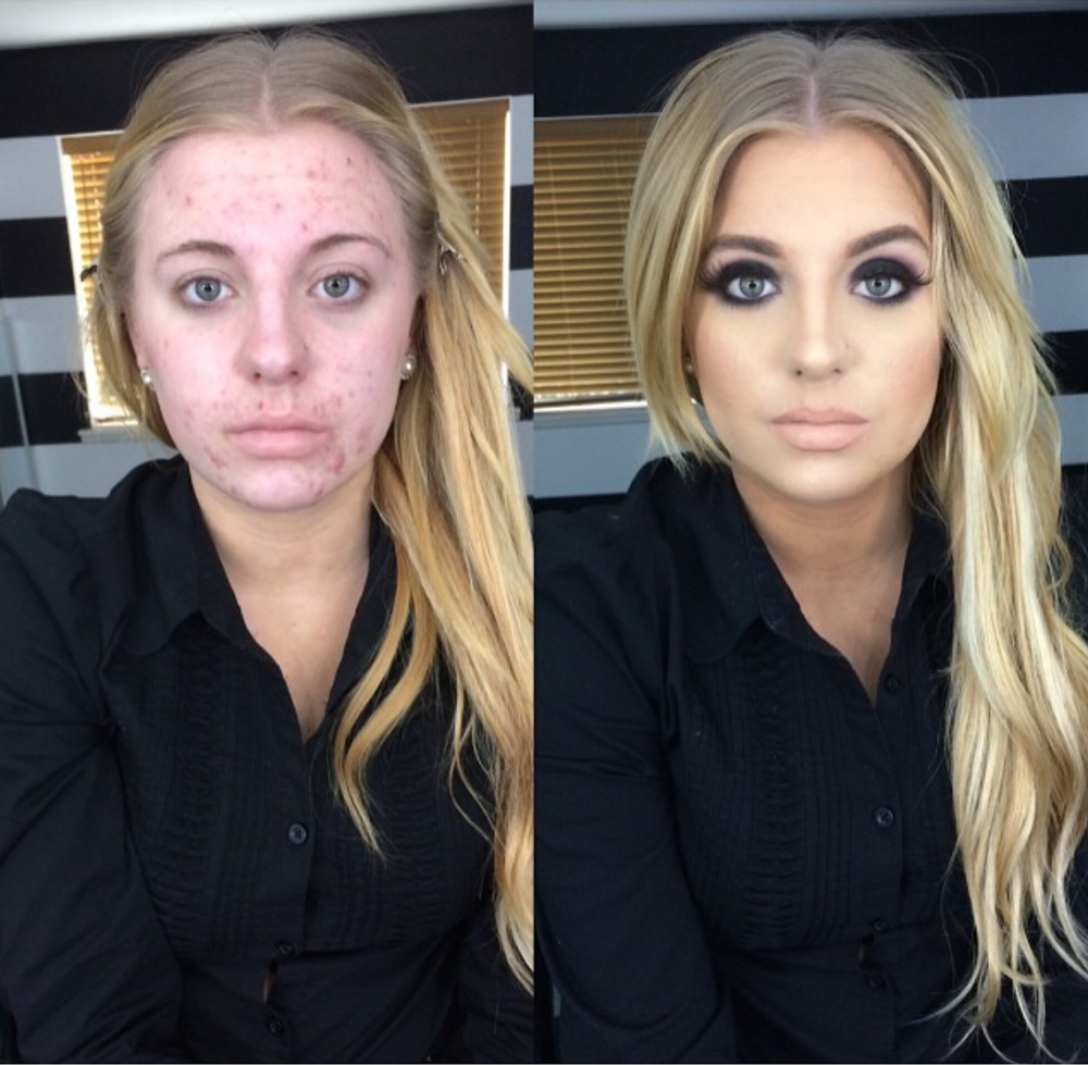 1 BK5r diN95ECdkbTifzi9A