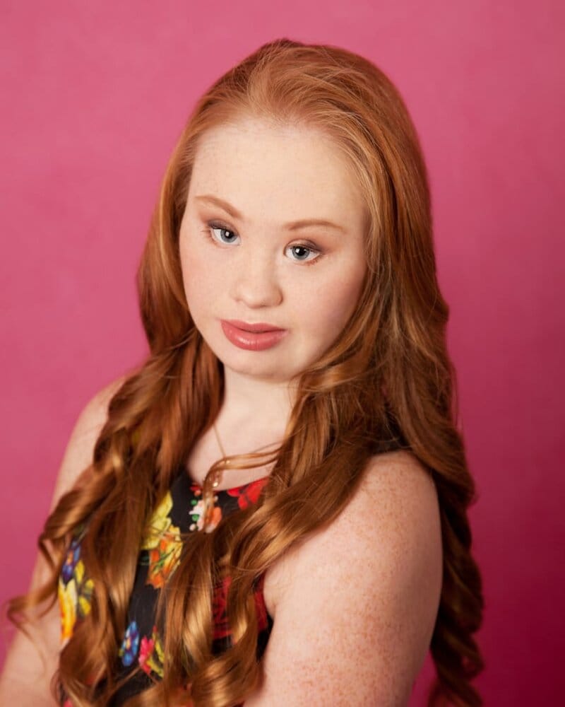 Madeline Stuart Model Down Syndrome
