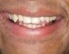 IMG 20210301 214736