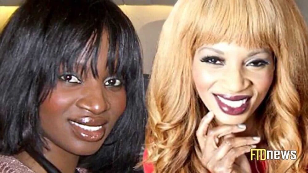 Skin Bleaching image