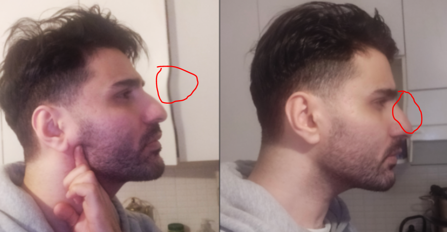 NOSE