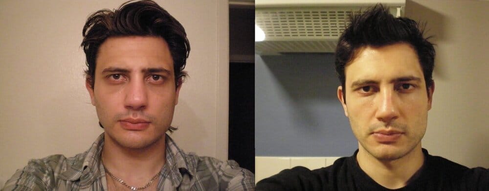 Before after front