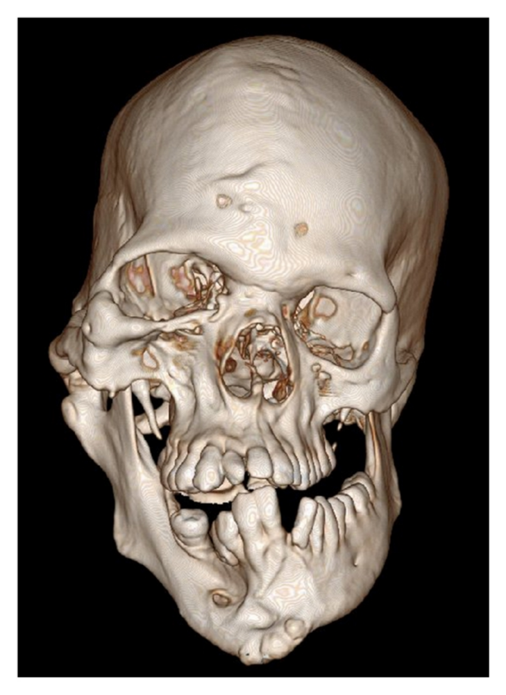 47F492B3 EB70 4EF6 AB0C A9591A7EC91A