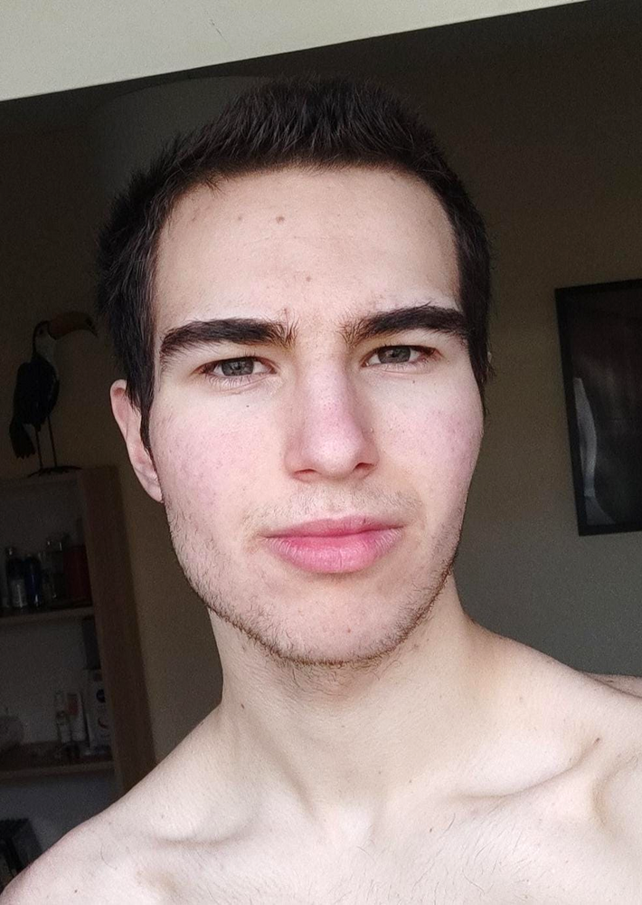 Improve