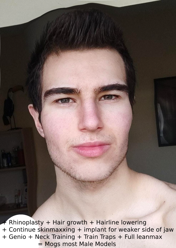 Improve 1
