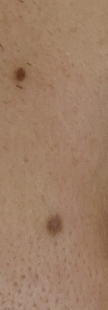 IMG 20210308 092418  01