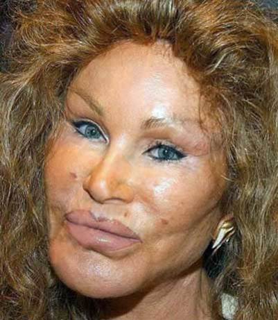 Jocelyn Wildenstein