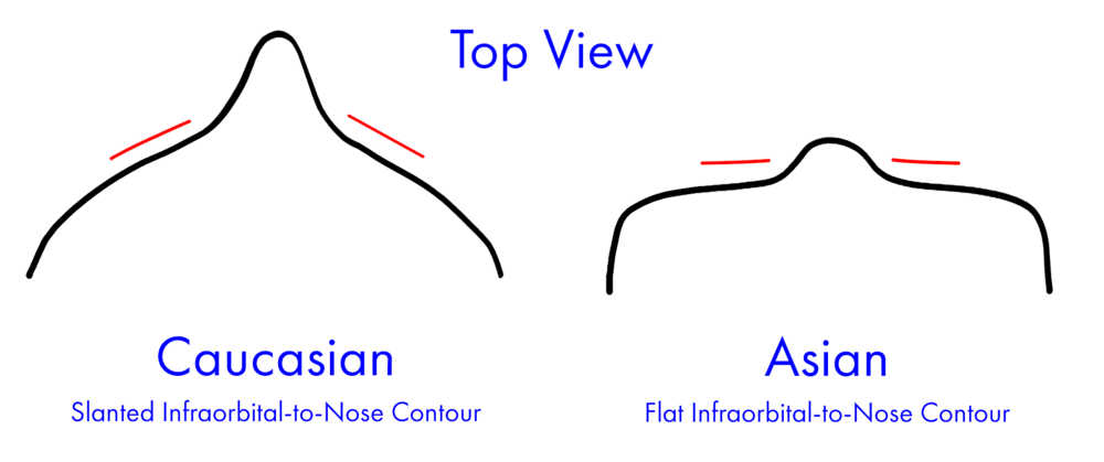 Forward Maxilla Is a Projected Nasal Area