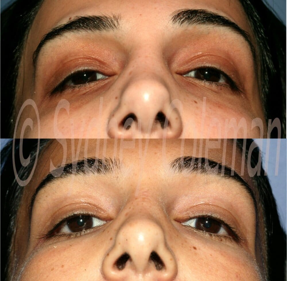 11000440 355E 491D 8CDA 091E883983EF
