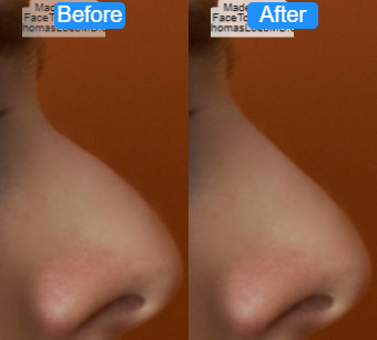 Nos after before after
