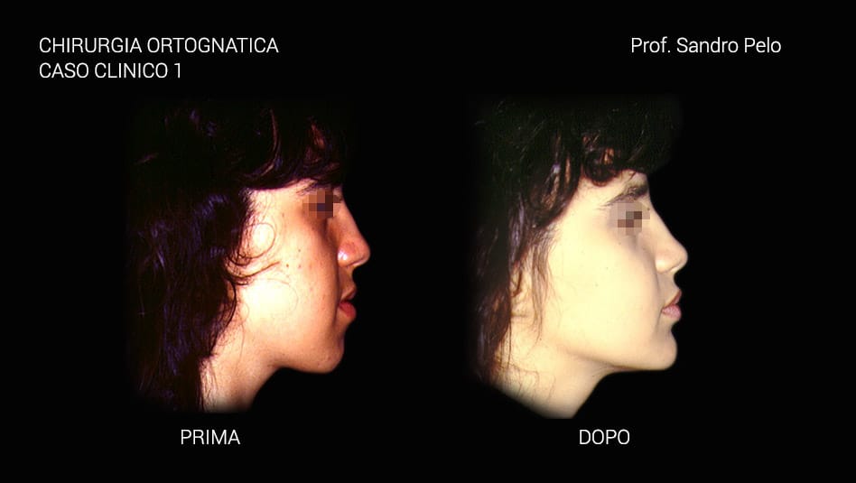 Co caso 112