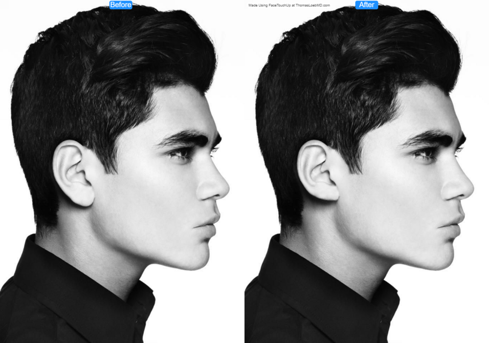 1234699 3301776 before after