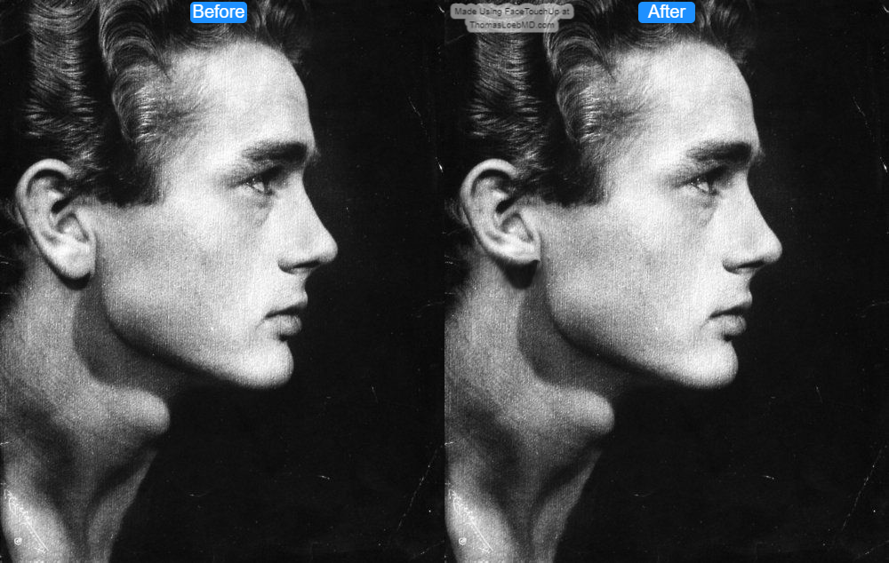 C07f3432c2398095049987fbfbfde5c4 before after