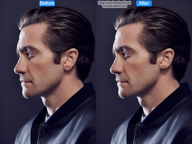 6314551644774f245da9740944a535a9 before after