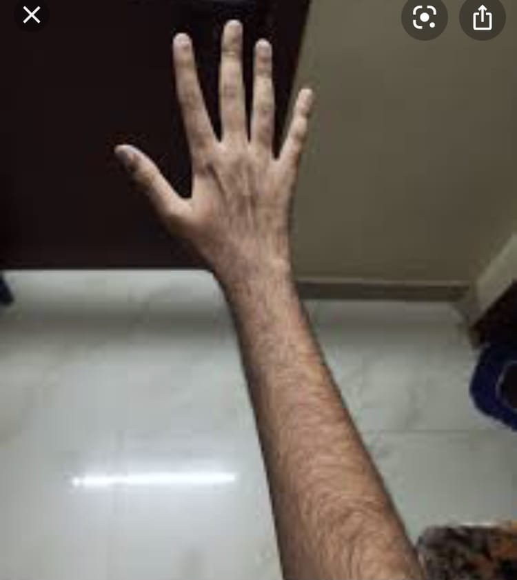 CC21CA15 5871 4AFF A7B2 C2ADC5E19DBF