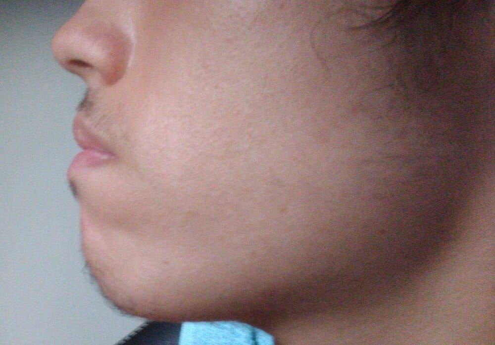 Error 404 chin not found