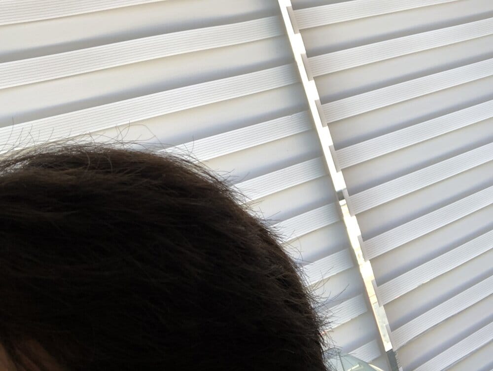 Hairdensity