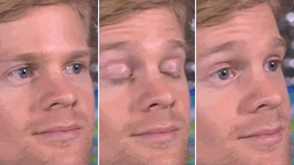 Skynews drew scanlon blinking white guy 4786055