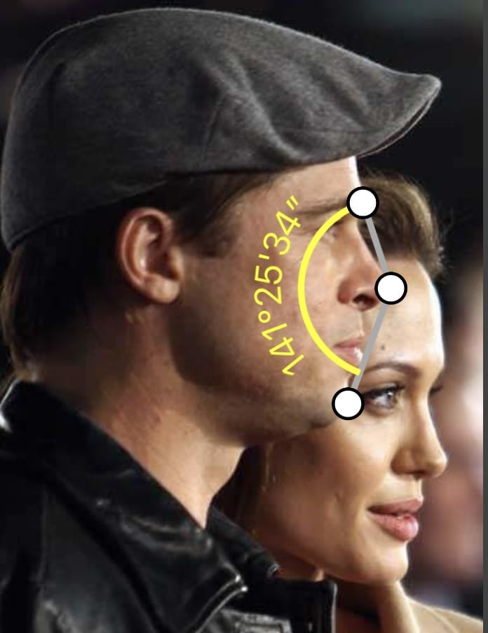 DB07FD98 584D 4BA1 8EF9 BBE68A2E27C2