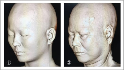 1 s20 S1748681519302360 gr3