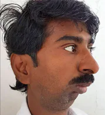 9PSL example