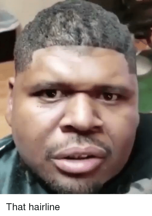 That hairline 34742621