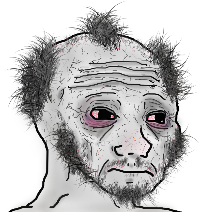 Wojak doomer male pattern baldness